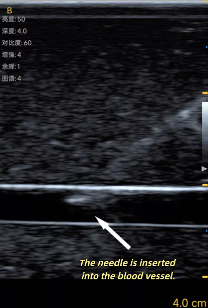 Modèle d'entraînement à la pon - Medical Gel Ultrasound avis et prix