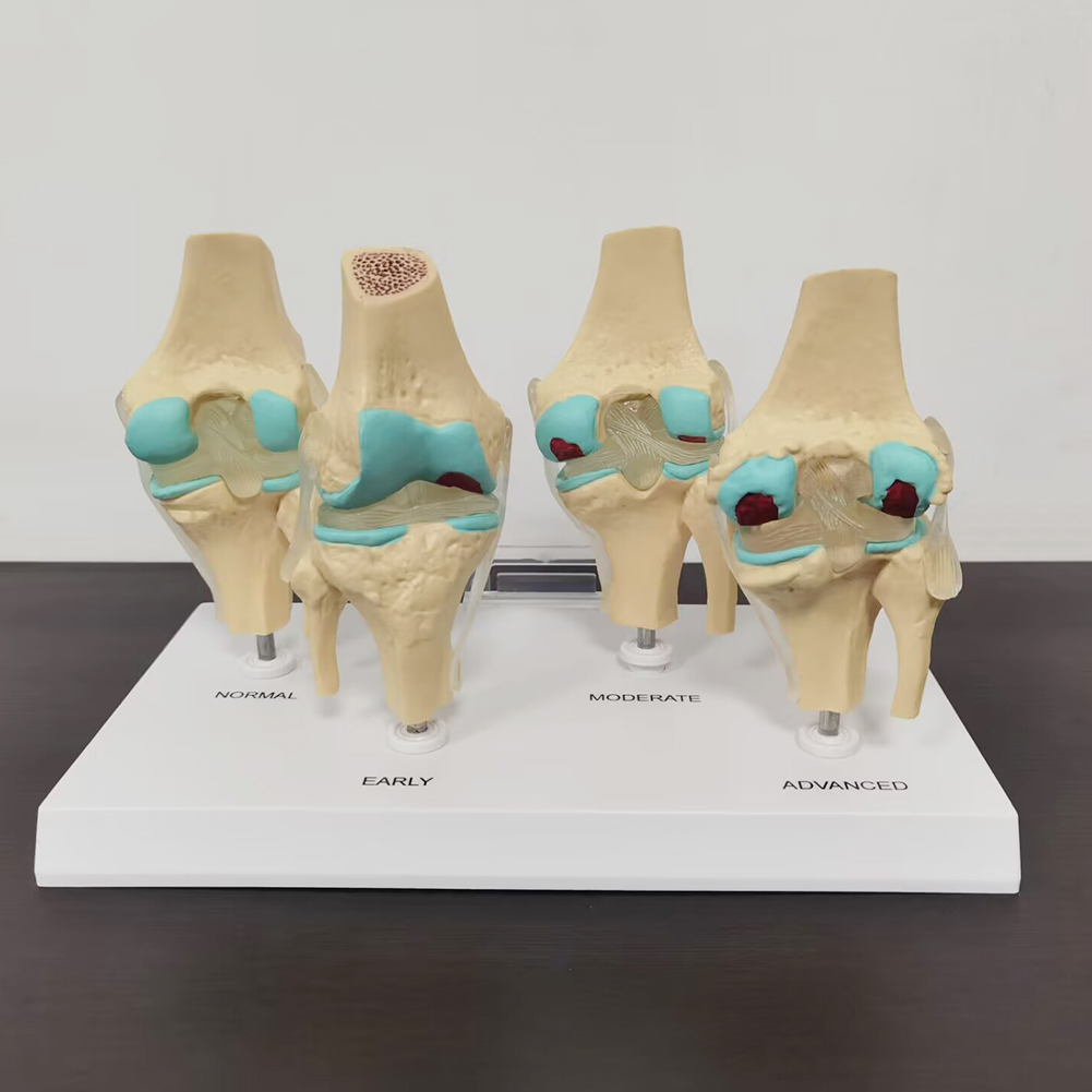 Modèle d'Li-du genou en plasti - Medical Lab Technology avis et prix