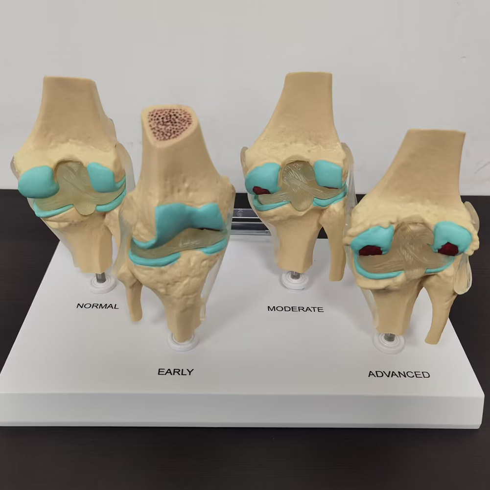 Modèle d'Li-du genou en plasti - Medical Lab Technology avis et prix