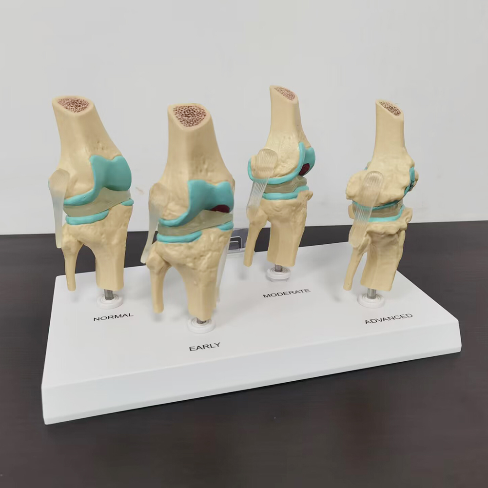 Modèle d'Li-du genou en plasti - Medical Lab Technology avis et prix